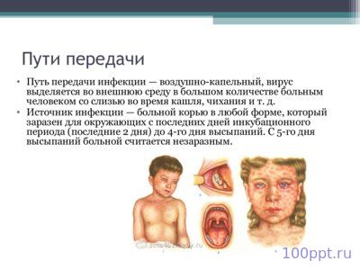 Презентация корь - слайд 2 2 слайд презентации корь