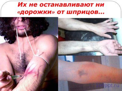 Презентация молодежь против наркотиков - слайд 7 7 слайд презентации молодежь против наркотиков