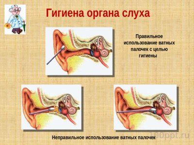 Презентация слуховой анализатор - слайд 12 12 слайд презентации слуховой анализатор